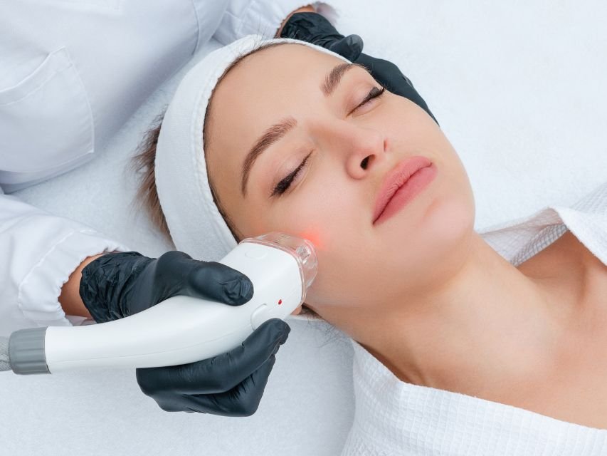laser-facial-onde-fazer-com-seguranca-em-sp
